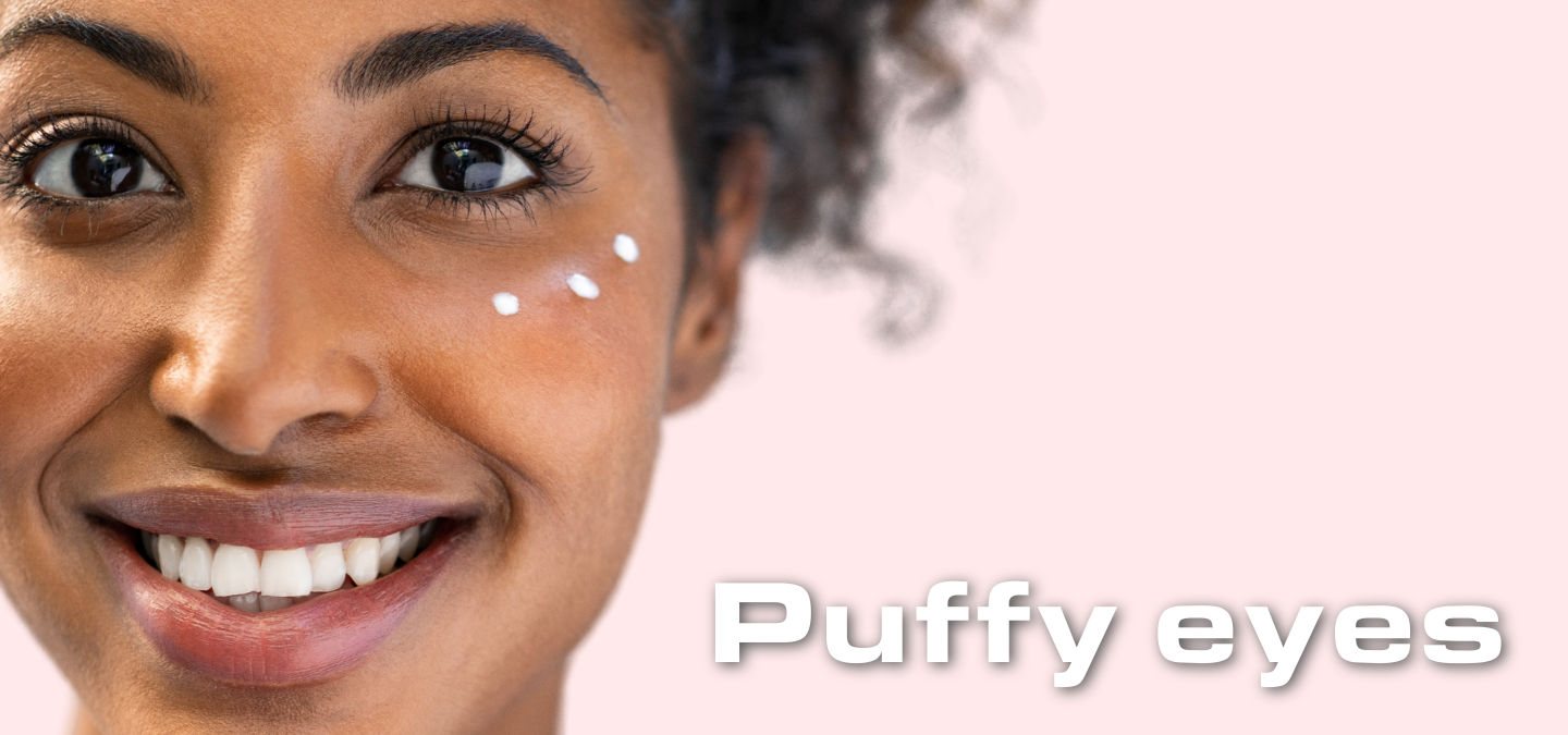 How to Get Rid of Puffy Eyes