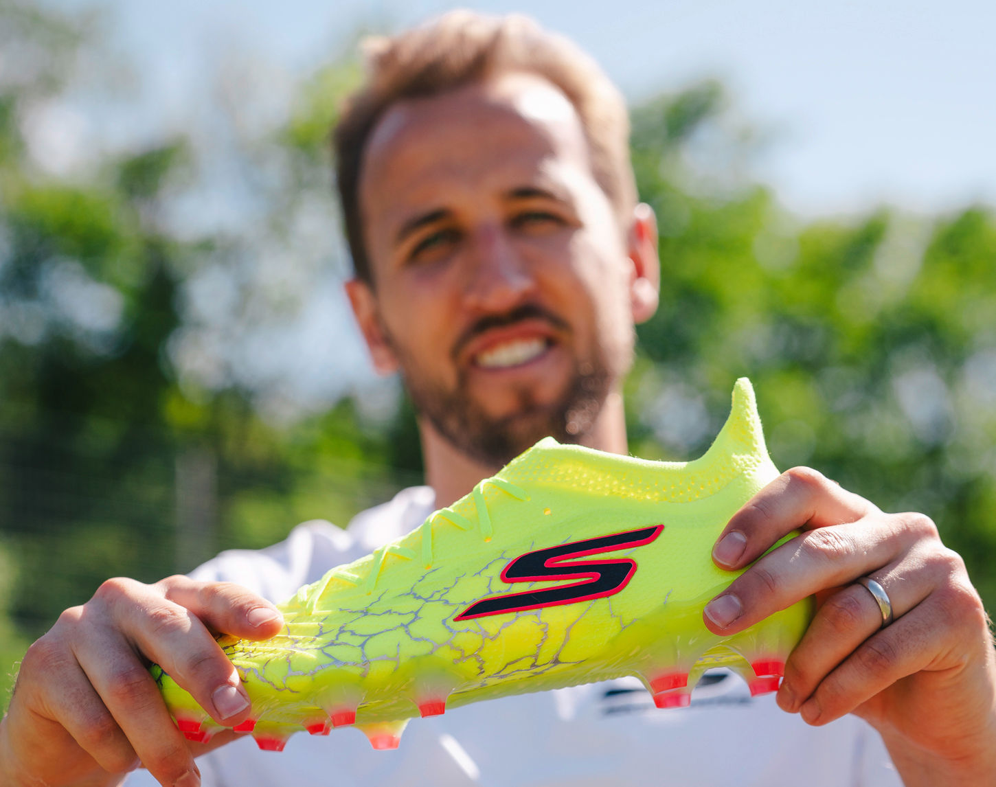 Skechers en Harry Kane